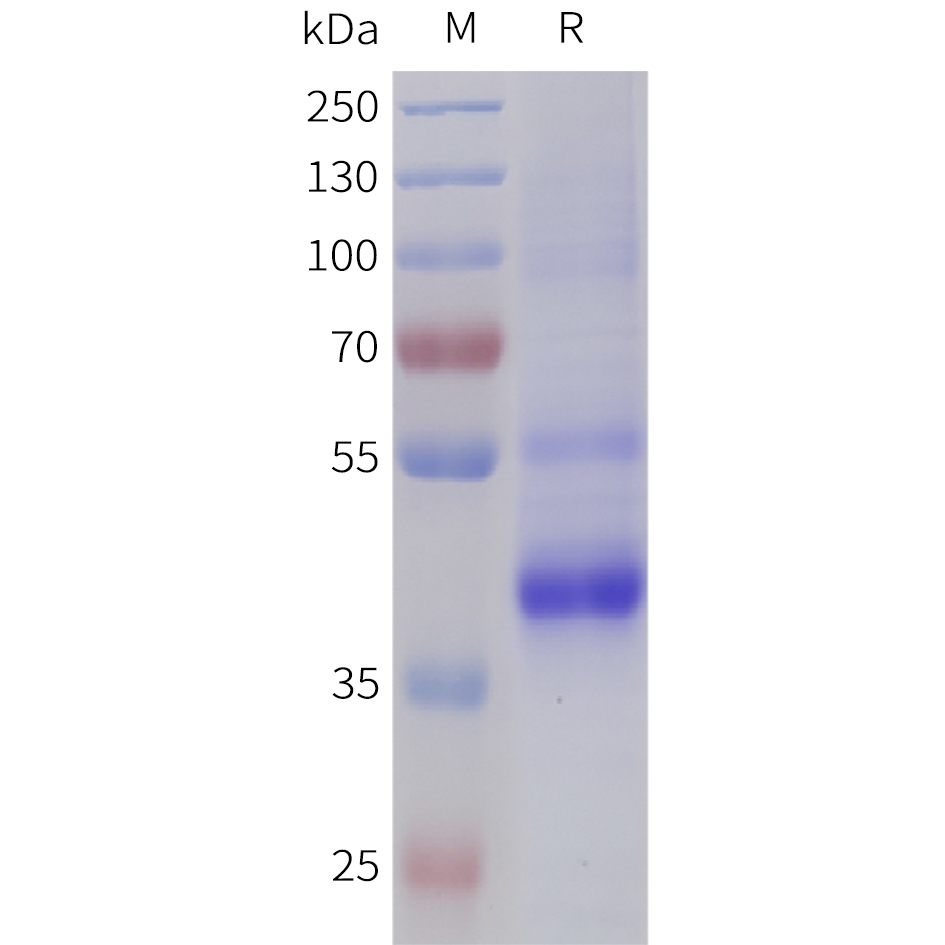 Recombinant human TGFB2(21-414) Protein with N-terminal 10?His tag