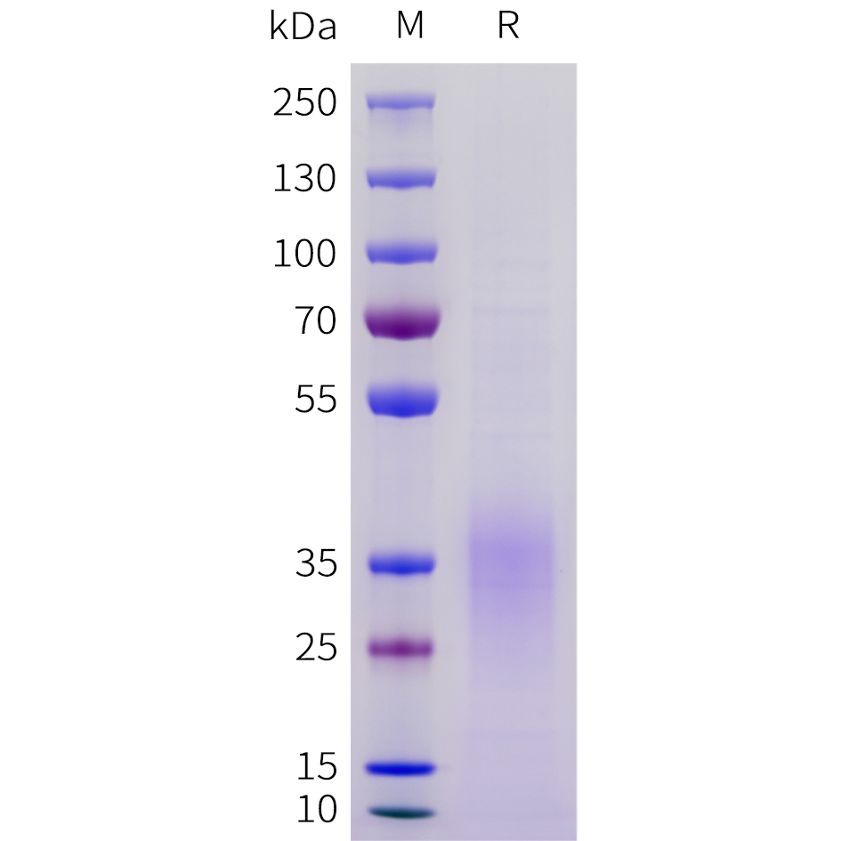 Recombinant human ACVR2B(19-137) Protein with C-terminal 10?His tag