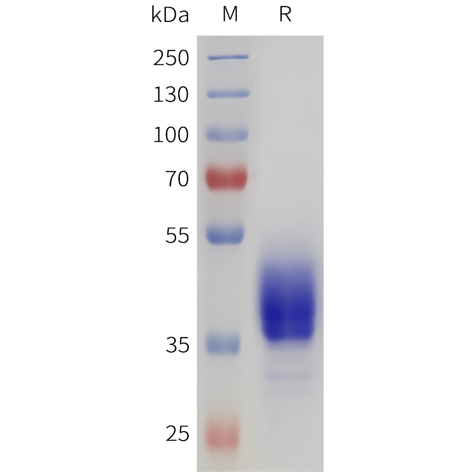 Recombinant human DRD2 Protein with C-terminal human Fc tag