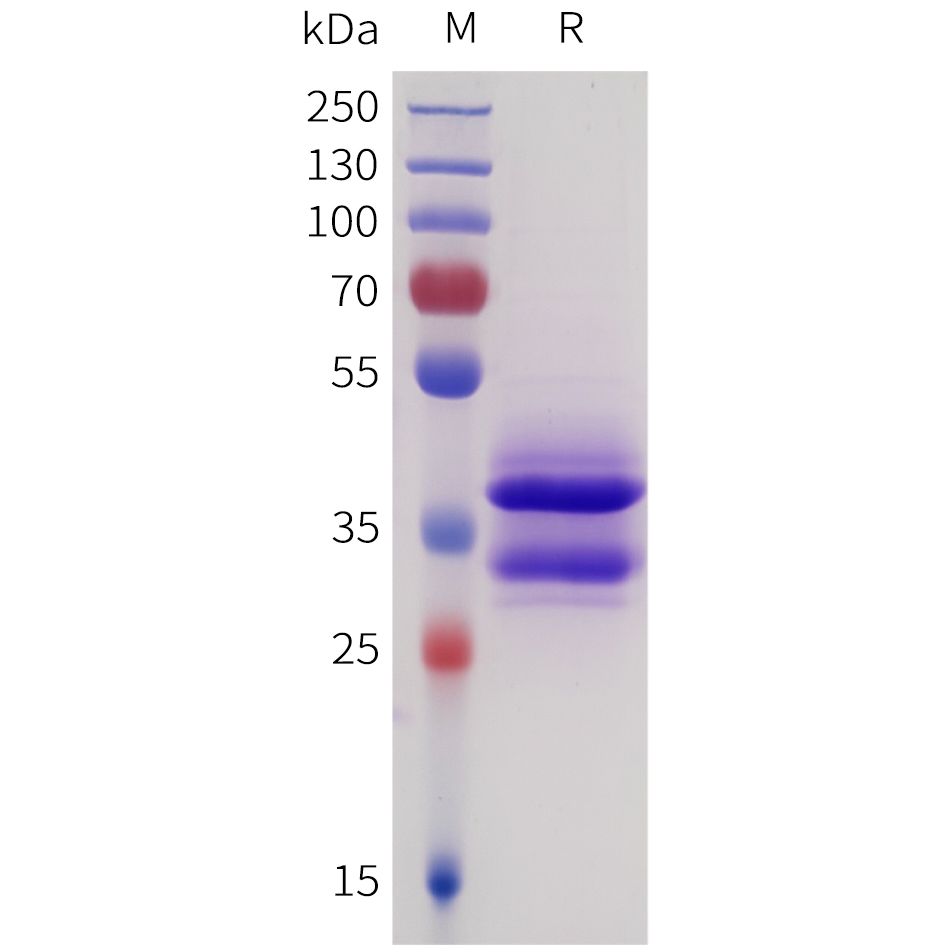 Recombinant human SEZ6(833-925) Protein with C-terminal human Fc tag
