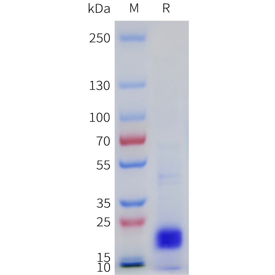 Recombinant human IL33(109-270) Protein with N-terminal 6?His tag