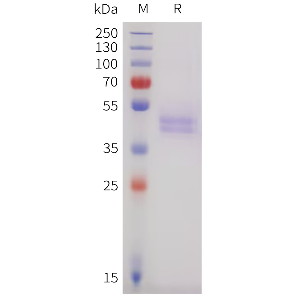 Recombinant human IGHE(106-427) Protein with C-terminal 10?His tag