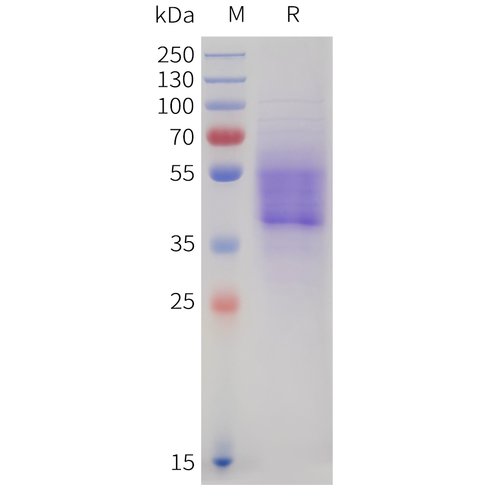 Recombinant human CB1(1-116) Protein with C-terminal mouse Fc tag