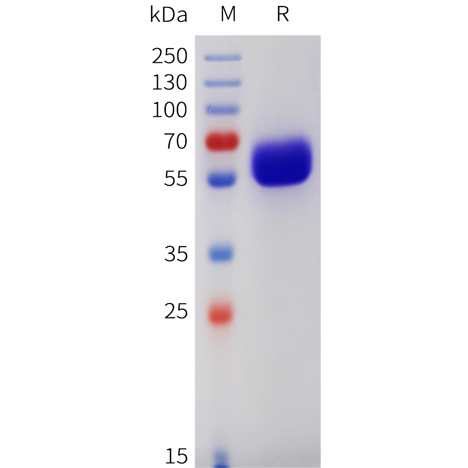 Recombinant human CSF2RB Protein with C-terminal 6?His tag