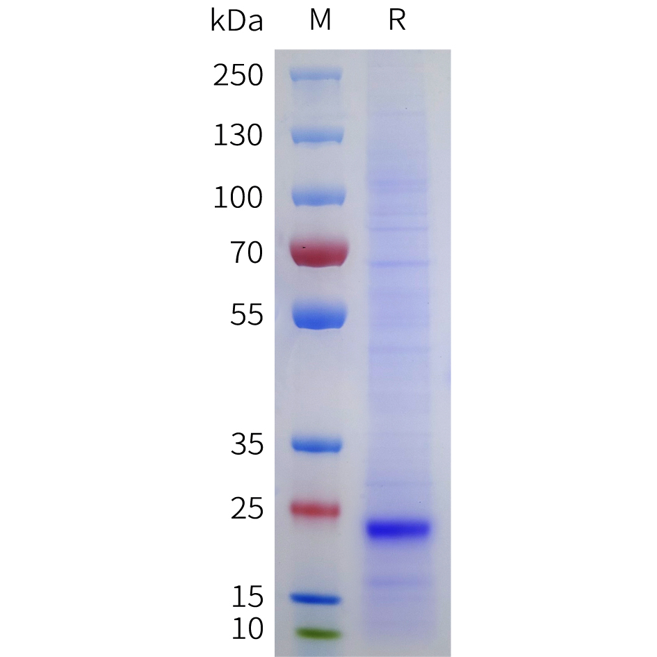 Recombinant human TIMP2 Protein with C-terminal 6?His tag