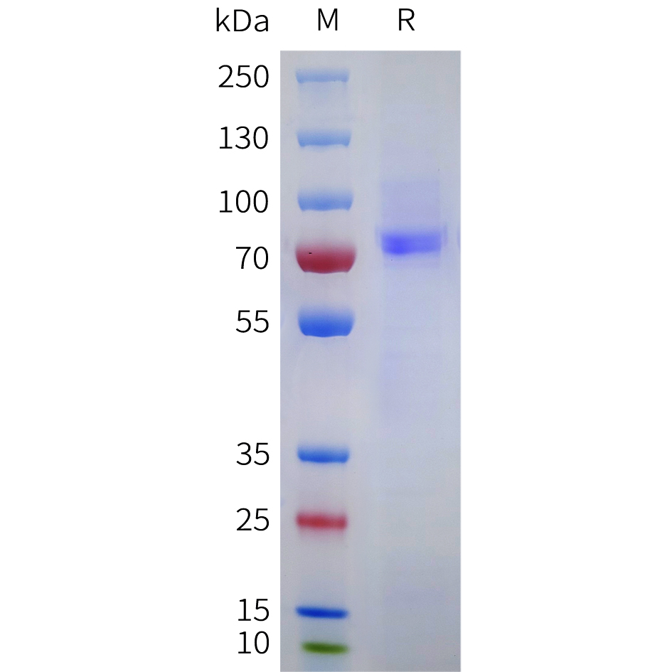 Recombinant human EPHA10 Protein with C-terminal 10?His tag