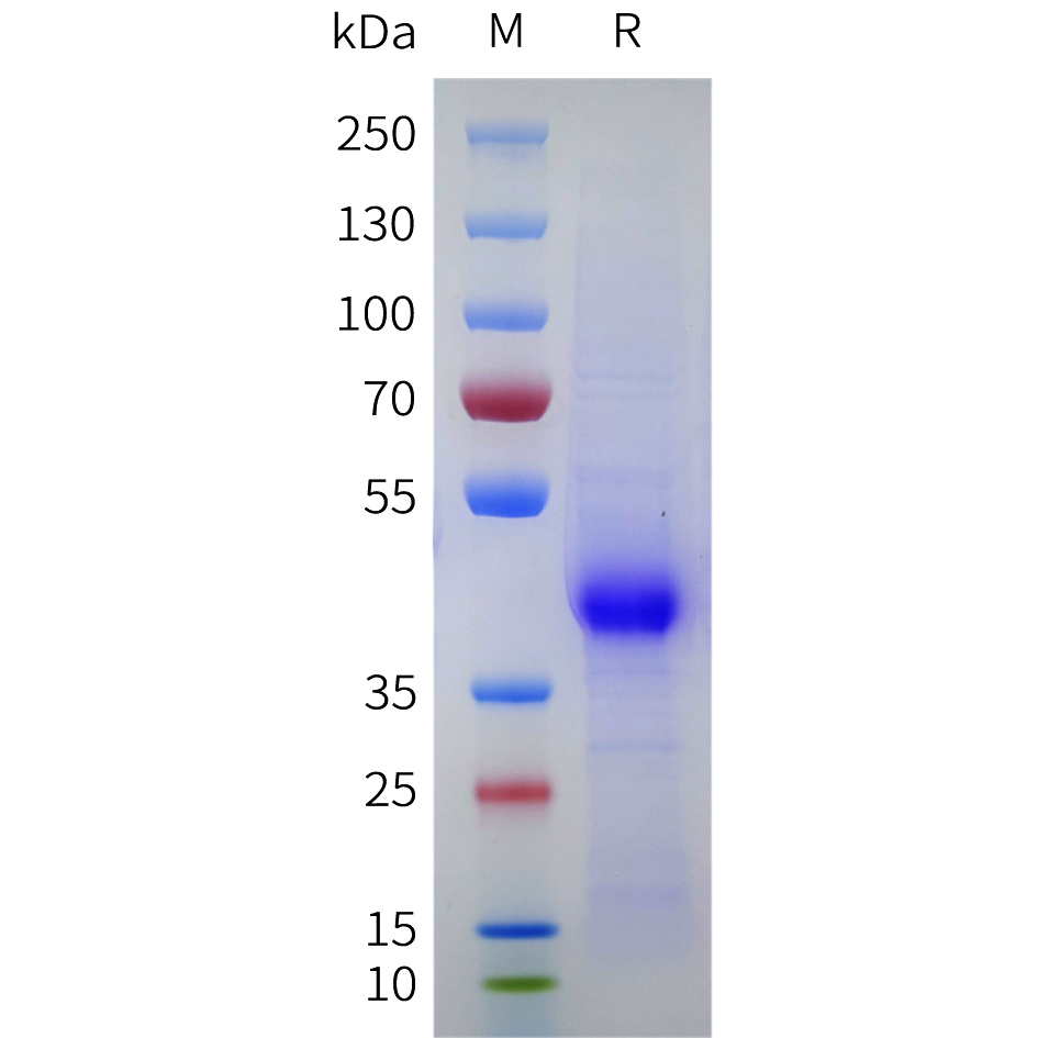 Recombinant human CD43 Protein with C-terminal 10?His tag