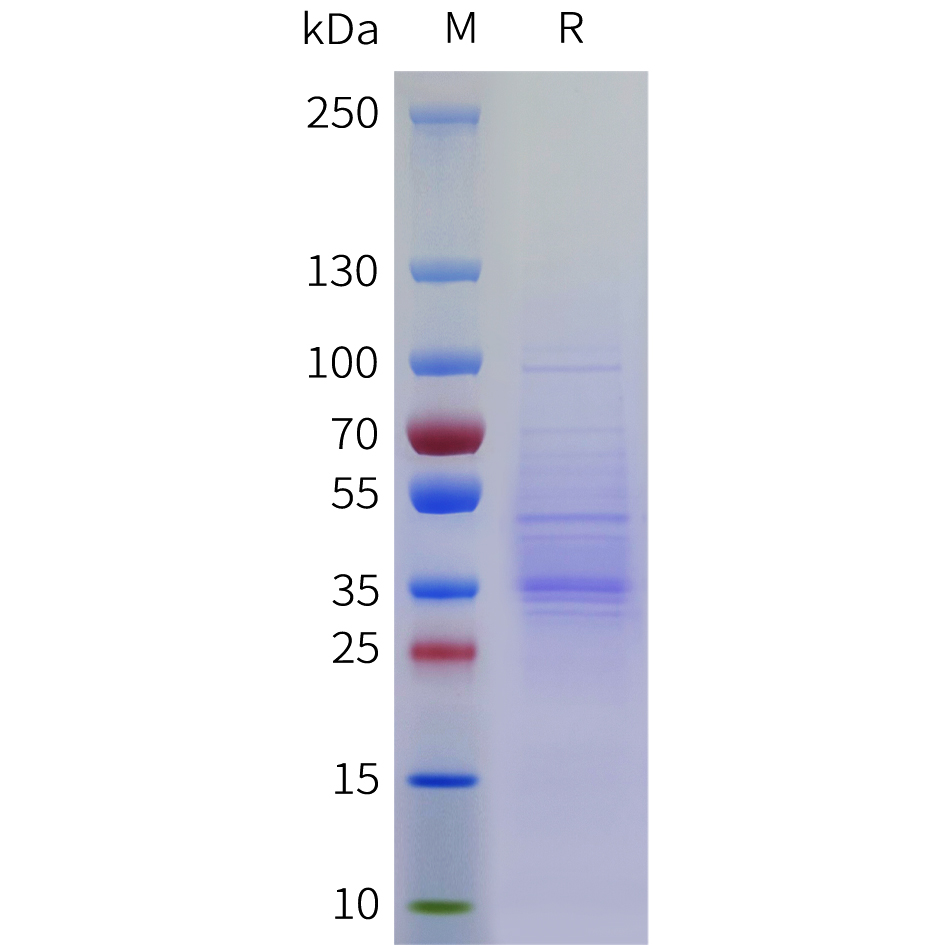 Recombinant human C1QBP Protein with C-terminal 6?His tag