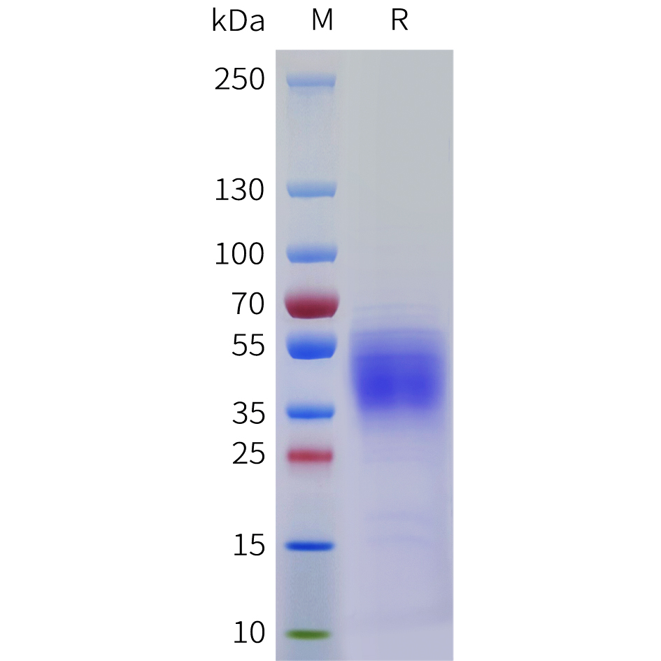 Recombinant human CD58 Protein with C-terminal 6?His tag