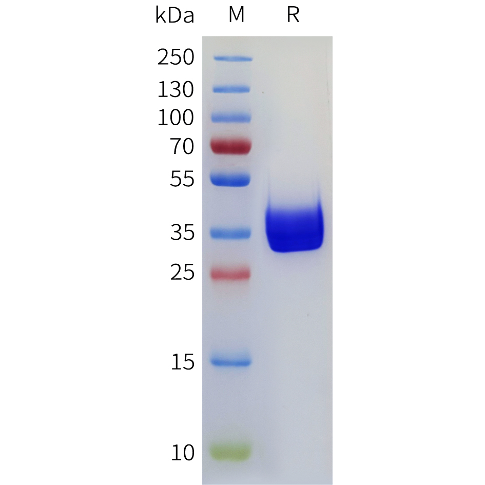 Recombinant human CD117 Protein with C-terminal mouse Fc tag