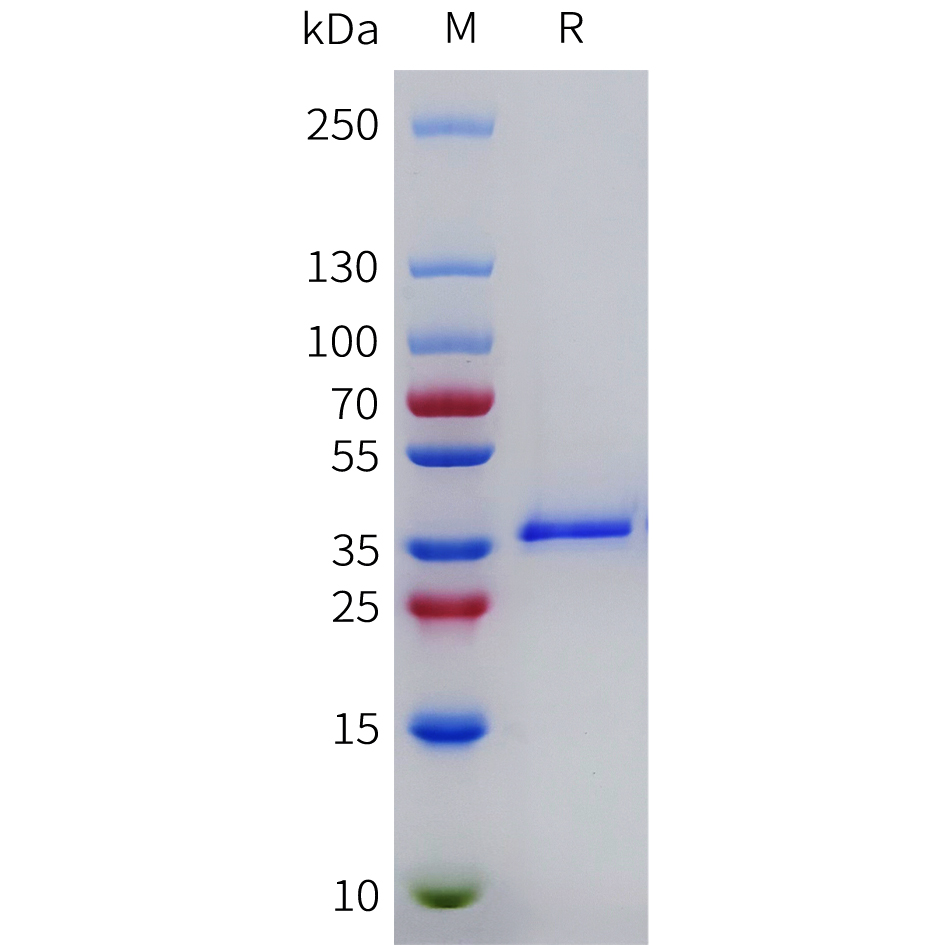 Recombinant human LGALS4 Protein with N-terminal 6xHis tag