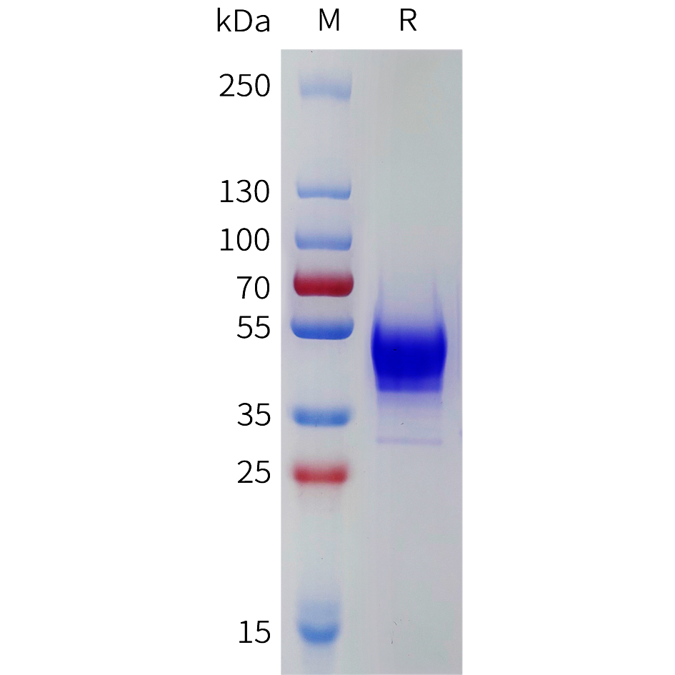 Recombinant human KISS1R Protein with C-terminal human Fc tag