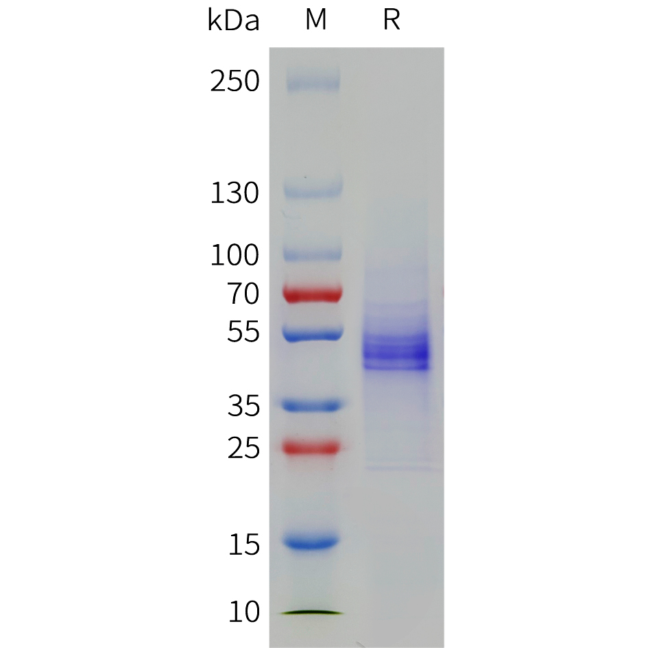 Recombinant human CD19 Protein with C-terminal 10xHis tag