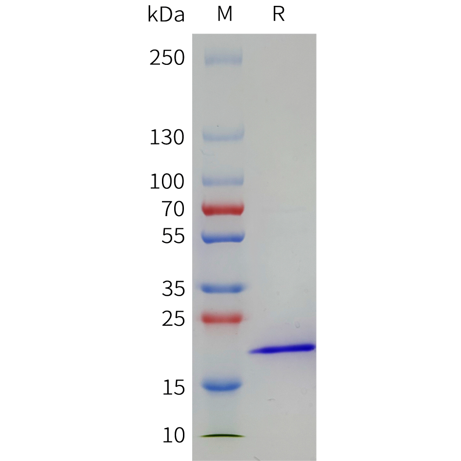 Recombinant human FGF21 Protein with C-terminal 10xHis tag