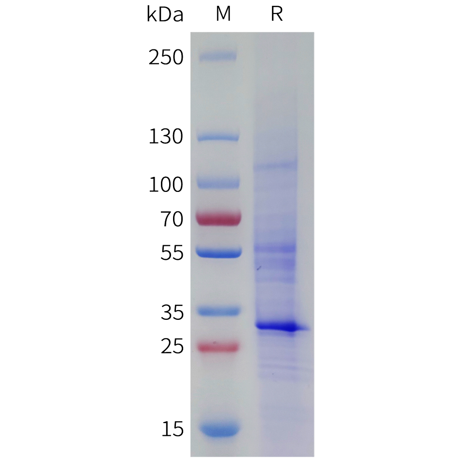 Recombinant human FCGRT Protein with C-terminal 10xHis tag