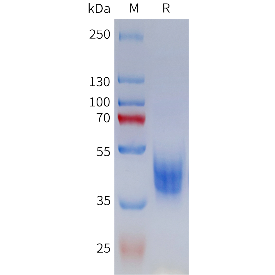 Recombinant human MC3R Protein with C-terminal human Fc tag