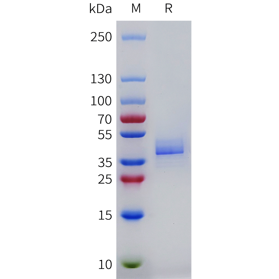 Recombinant Mouse CXCR2 Protein with C-terminal human Fc tag