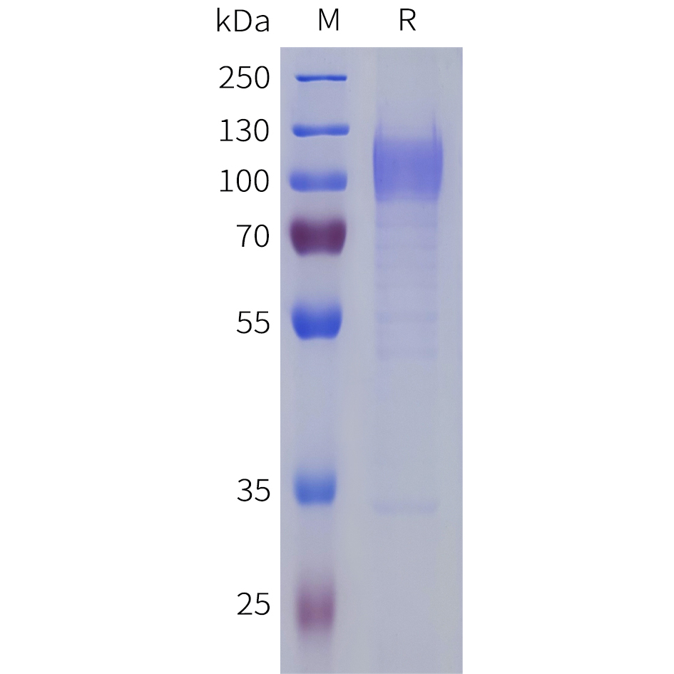 Recombinant human LRRC4 Protein with C-terminal 6xHis tag