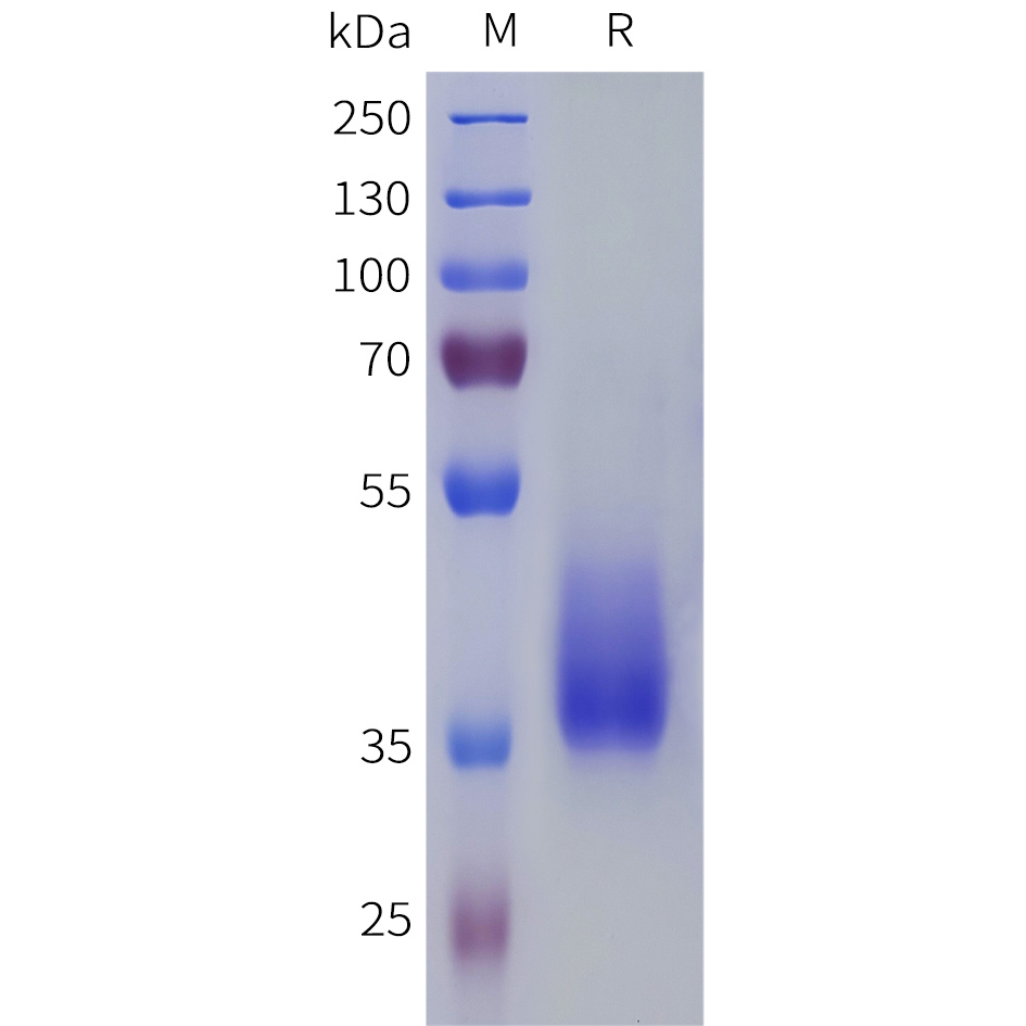 Recombinant human PTGFR Protein with C-terminal human Fc tag