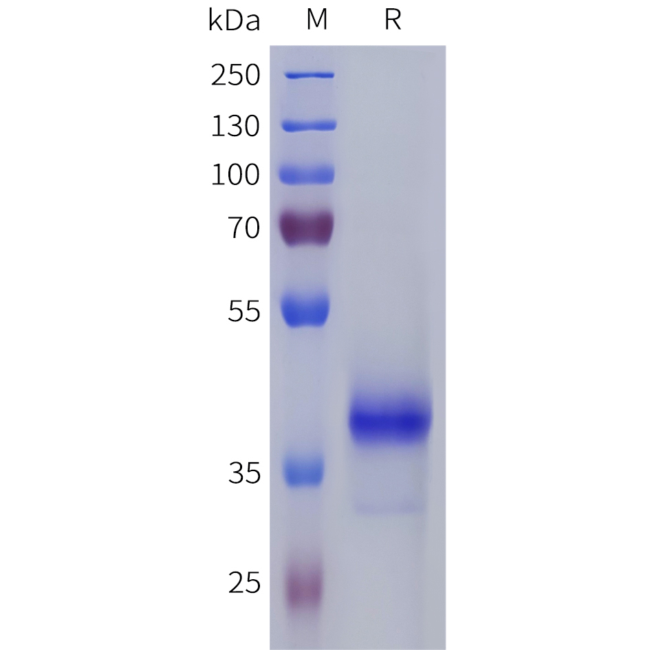 Recombinant human S1PR5 Protein with C-terminal human Fc tag