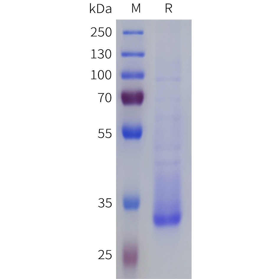 Recombinant human TAS2R38 Protein with C-terminal human Fc tag
