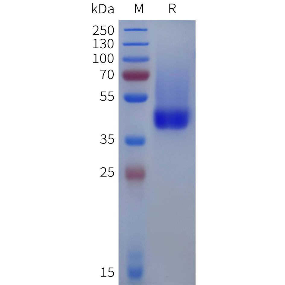 Recombinant human DCN(31-359) Protein with C-terminal 6xHis tag