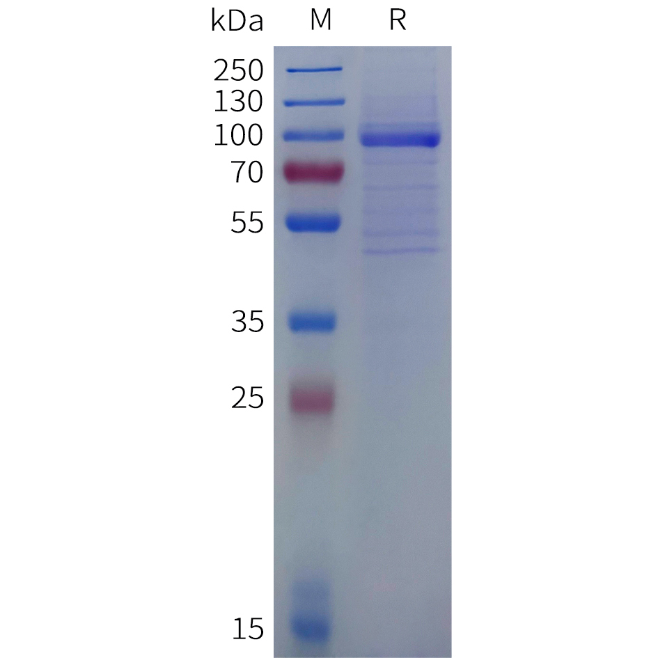 Recombinant human OLFML3 Protein with N-terminal human Fc tag