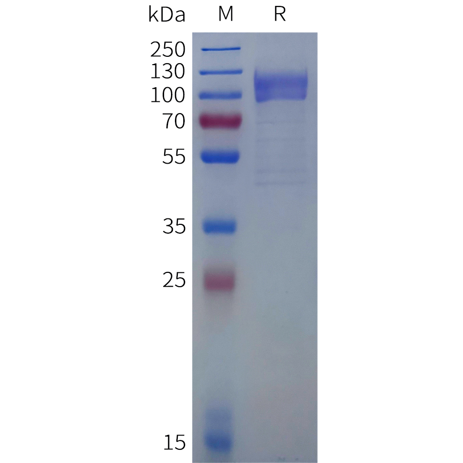 Recombinant human IL27RA(33-516) Protein with C-terminal human Fc tag