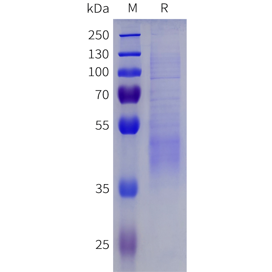 Recombinant human IGFBP3 Protein with C-terminal 6xHis tag