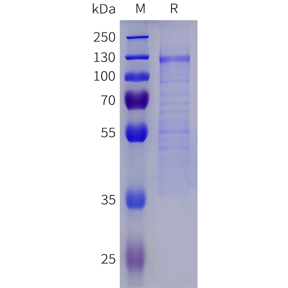 Recombinant human KL Protein with C-terminal 6xHis tag
