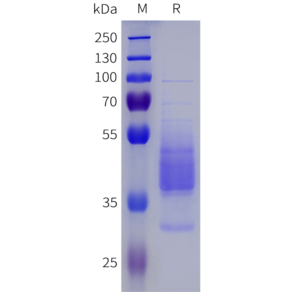 Recombinant human NPY1R Protein with C-terminal human Fc tag