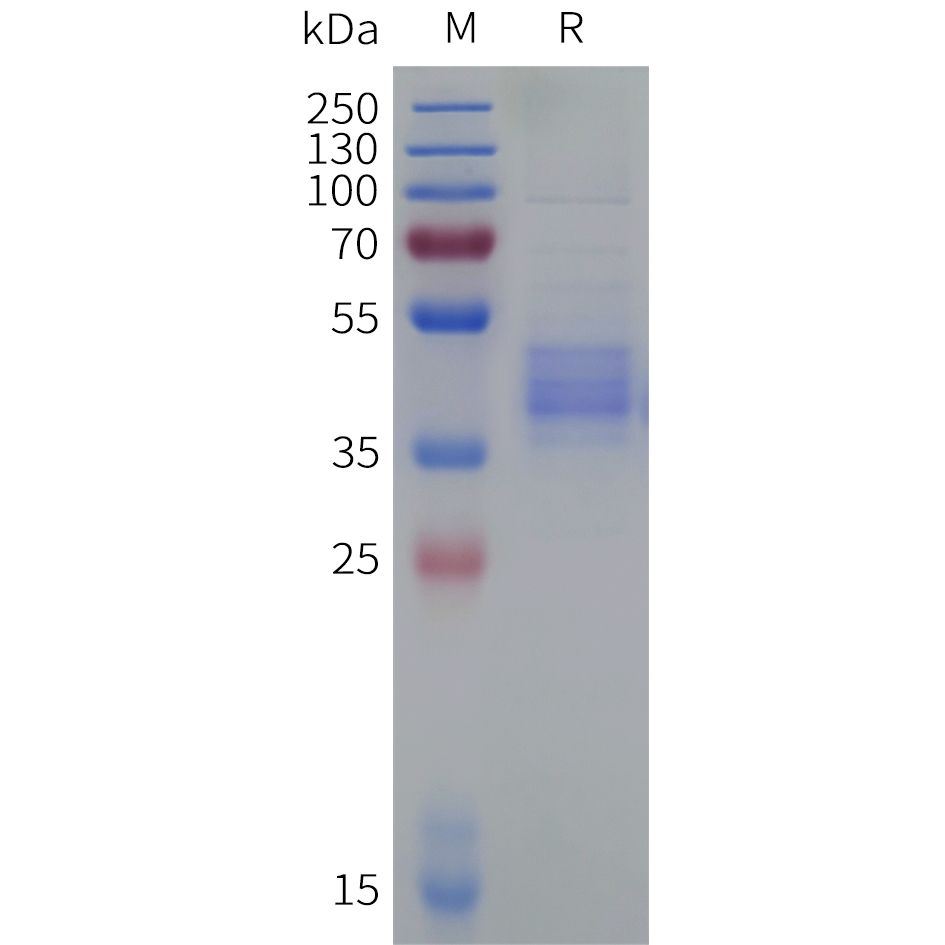 Recombinant human ACKR2 Protein with C-terminal human Fc tag