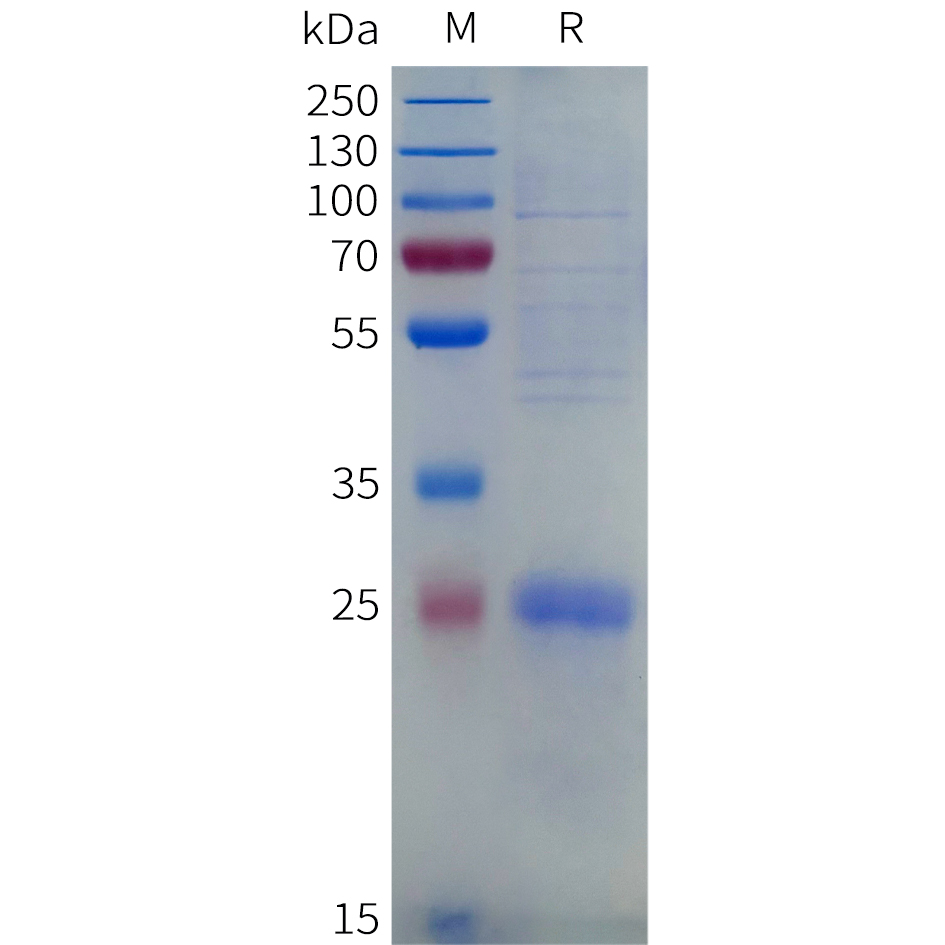 Recombinant human CD8A Acidic tail Protein with C-terminal 6xHis tag