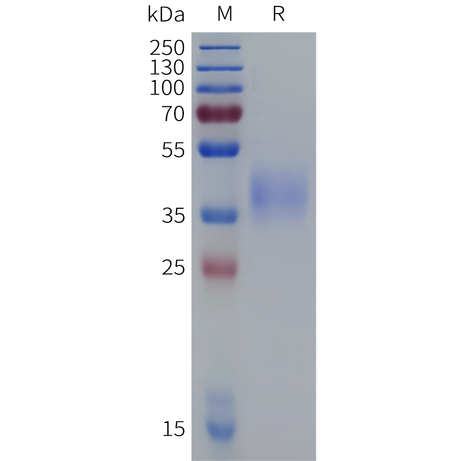 Recombinant mouse IL4RA protein with C-terminal 10xHis tag