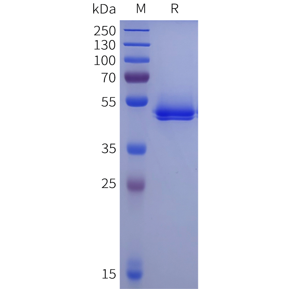 Recombinant human ACPP Protein with C-terminal 10xHis tag