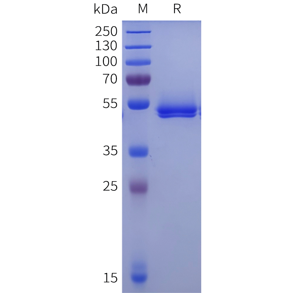 Biotinylated Recombinant human ACPP Protein with C-terminal 6xHis tag