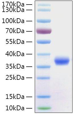 Recombinant Sars-Cov-2 (COVID-19/2019-nCov) Spike RBD Protein