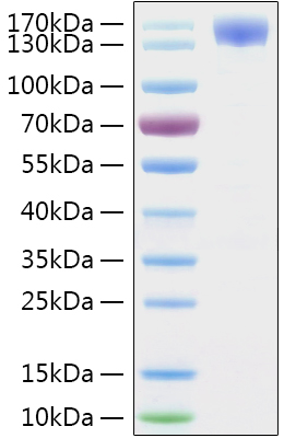 Recombinant Sars-Cov-2 (COVID-19/2019-nCov) Spike S1 Protein