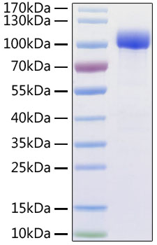 Recombinant Human ACE2 Protein with His and Avi tag