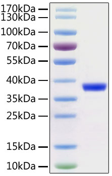 Recombinant 2019-nCoV 3C-like Proteinase with His and Avi tag