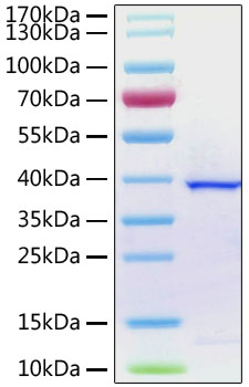 Recombinant SARS-CoV-2 papain-like protease with His tag