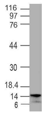 Recombinant Human Small Nuclear Ribonucleoprotein Polypeptide D1