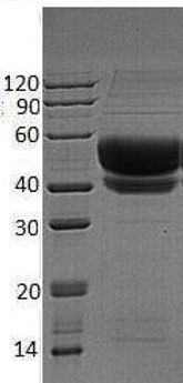 Recombinant Human  beta-Galactoside a-2,6-Sialyltransferase 1/ST6GAL1 (C-6His)