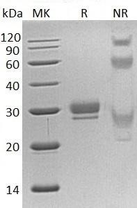 Recombinant Human CTHRC1/NMTC1 (C-6His) in 293HEK cells