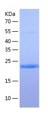 Recombinant Human  beta-Casein/CSN2/CASB (N-6His)(Discontinued)