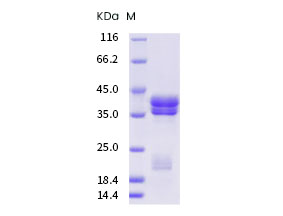 Recombinant Human Interleukin-17A/F Heterodimer/IL-17A & IL-17F (C-6His)(Discontinued)