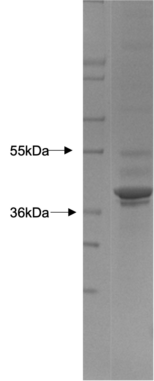 Recombinant Human Leukocyte Elastase Inhibitor/Serpin B1/SERPINB1 (C-6His)