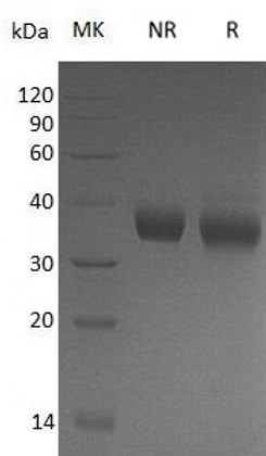Recombinant Mouse Prolactin Receptor/PRLR (C-6His)