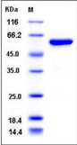 Recombinant Human Aldehyde Dehydrogenase 1-A3/ALDH1A3 (N-6His)(Discontinued)