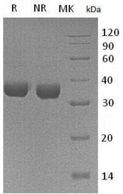 Recombinant Human Tryptase alpha/beta-1/TPSAB1 (C-6His)